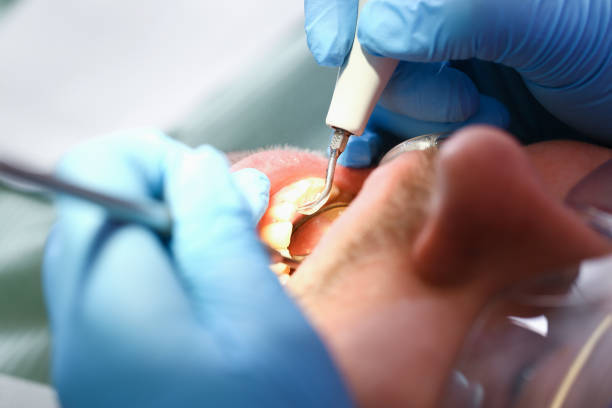 Best Cosmetic Emergency Dentistry in Somerset, WI